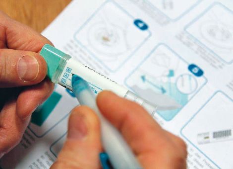 Neuer Test zur Darmkrebsfrüherkennung